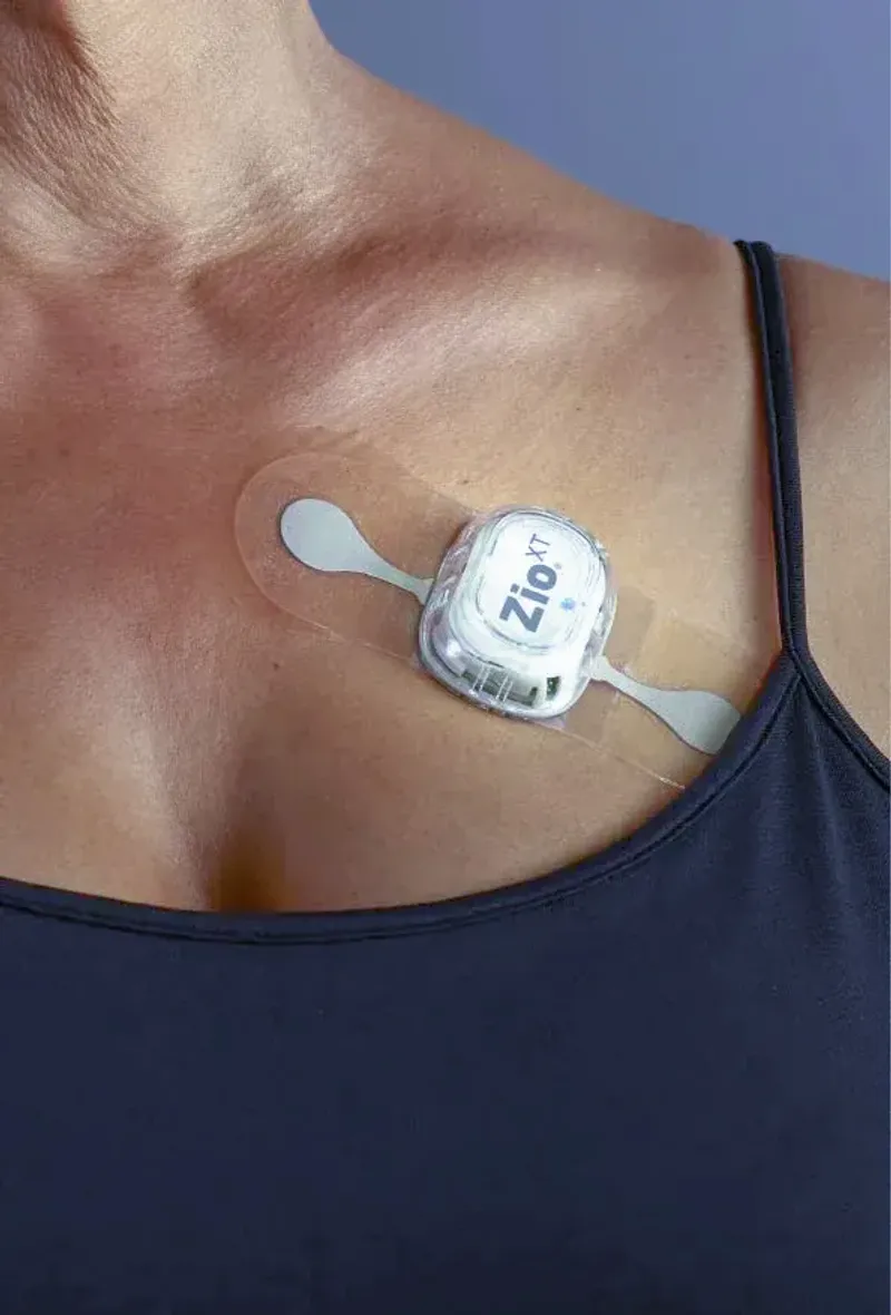 Market access and device launch for innovative cardiac monitoring tool